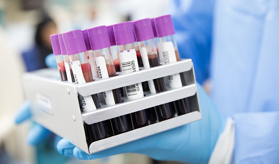 El Papel Crucial de la Donación de Muestras en la El Papel Crucial de la Donación de Muestras en la Investigación de la Salud Cardiovascular Femenina