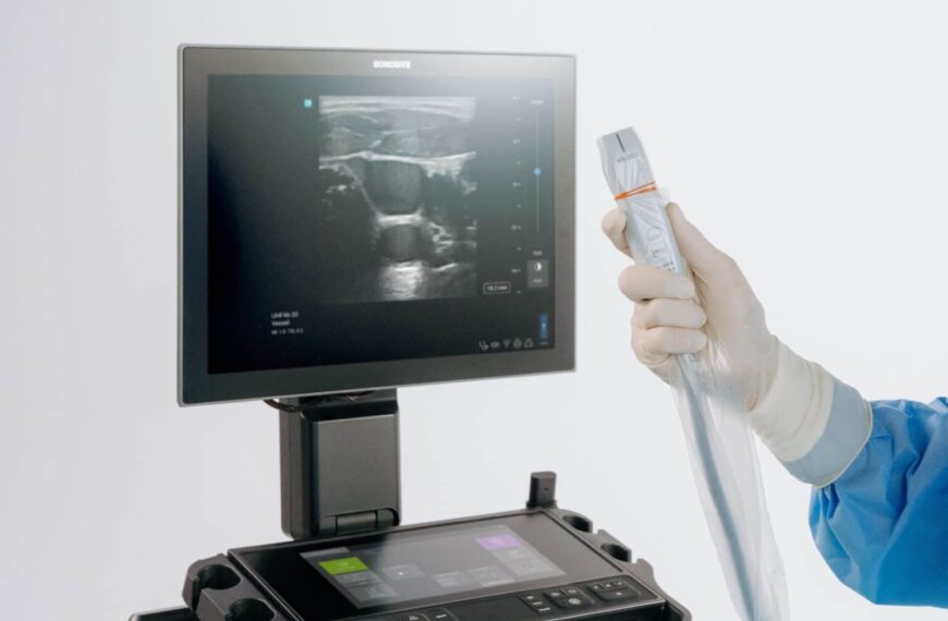 Sonosite LX introduce la ultra-alta frecuencia en POCUS con el primer y único transductor de 46 MHz