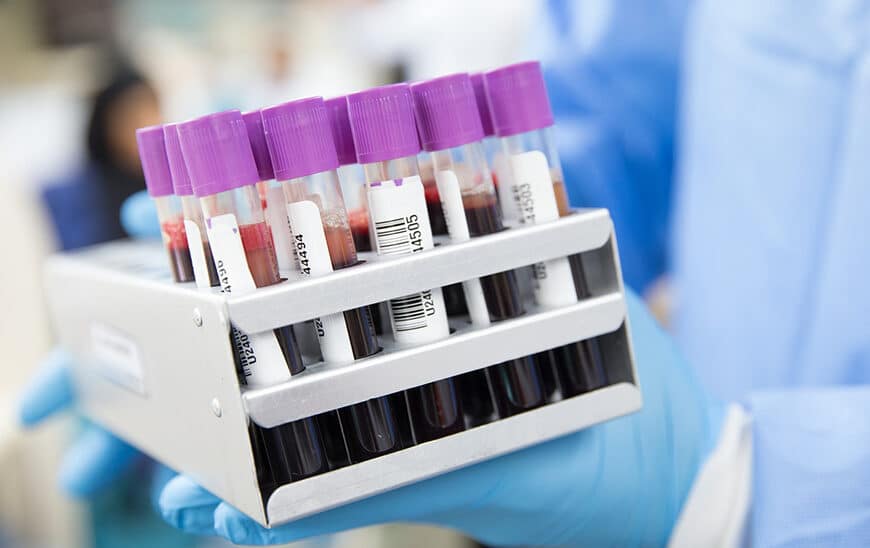 Sanidad Incentiva Donaciones Navideñas tras Superar 250,000 Muestras de Sangre en 2025